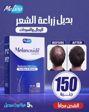 Melano Melanoxidil solution packaging with 'Before' and 'After' hair loss comparison on a blue background.